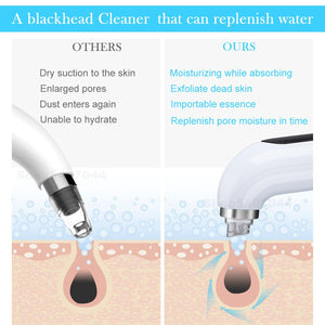 white head remover  vacuum pore cleaner  pore vacuums  pore cleaner tool  Pore cleaner  pimple remover machine  nose blackhead remover  blackhead vacuums  Blackhead sucker  blackhead remover tool  blackhead remover mask  blackhead remover machine  blackhead remover cream  blackhead remover  blackhead extraction tool  blackhead extraction  best blackhead vacuum  best blackhead remover tool  best blackhead remover for nose  best blackhead remover